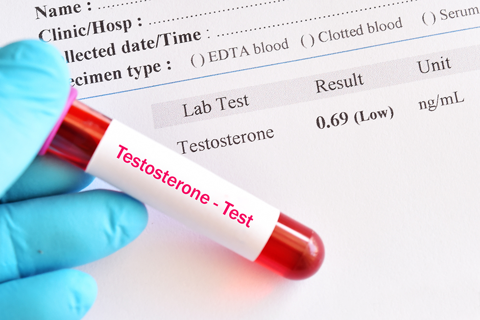 TRT for Men: Low Testosterone Signs, Benefits & Risks